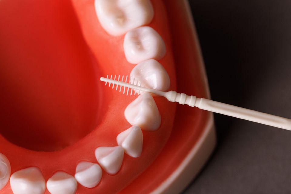 ������ �������: ������ ������ ����� �� ������ ��� ��������