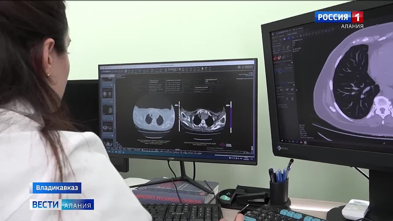 В Северной Осетии с начала года провели более 65 тысяч исследований с использованием ИИ