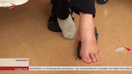 В РКБ провели редкую операцию с диабетической стопой