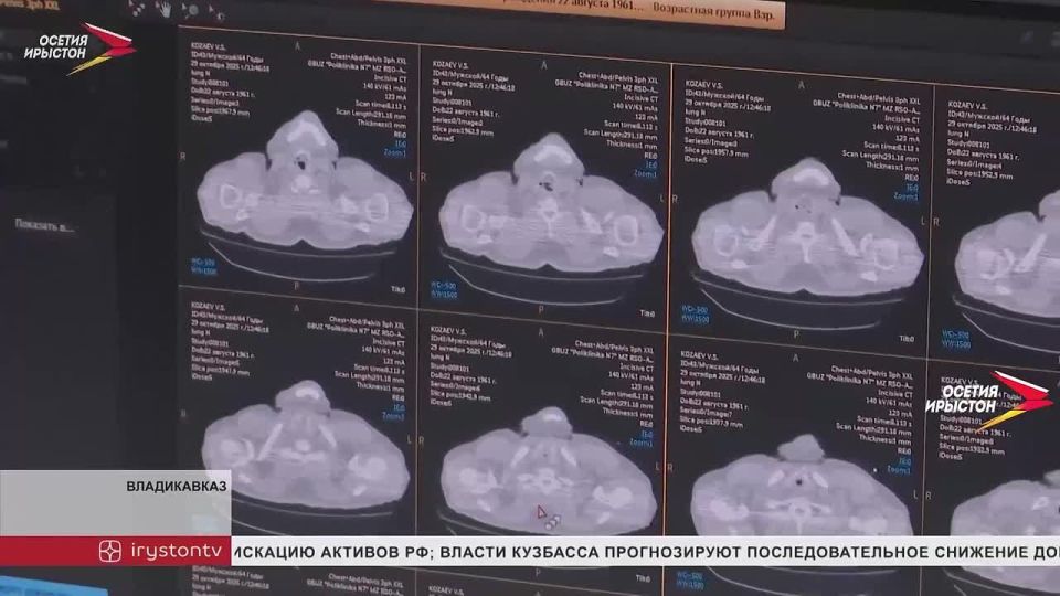 Медики Северной Осетии активно используют искусственный интеллект в лучевой диагностике