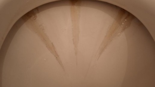 Секреты чистоты: как за 8 рублей поддерживать идеальный унитаз