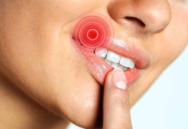 ������ ������ ����� �����: ����, ������� � ����������� ������ �������