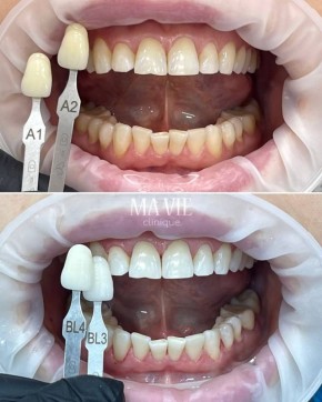 ���� �� �����: �������� �� ��� ��� �������